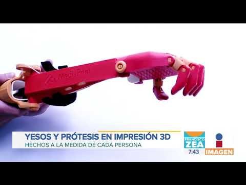 Este mexicano crea yesos y prótesis, y los dona a víctimas de todo México | Noticias con Zea