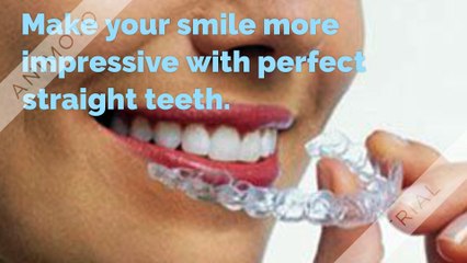 Best Invisalign Treatment