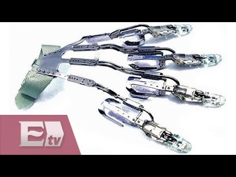 X-Fingers, la prótesis que cambia la vida a quienes han perdido dedos/ Hacker