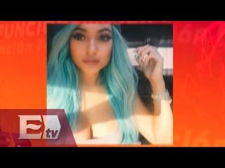 Kyile Jenner si se engrosó los labios / Joanna Vegabiestro