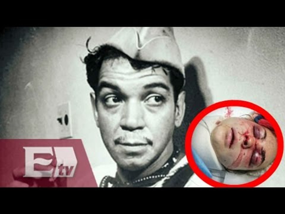 Marisa Moreno agradece apoyo tras sufrir brutal golpiza por su esposo