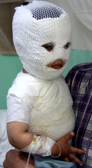 Doğu'da 400 Kişi Tandır ve Süt Kazanında Yandı