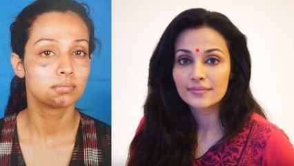 Stree Actress Flora Saini speaks on getting assaulted by Producer Gaurang Doshi | FilmiBeat