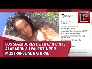 Rihanna se muestra con estrías y es aplaudida