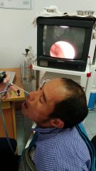 Une sangsue dans le nez d'un homme