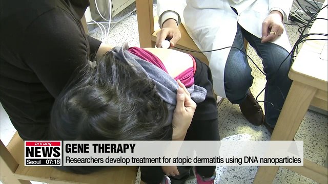 Researchers develop atopic dermatitis treatment using DNA nanoparticles