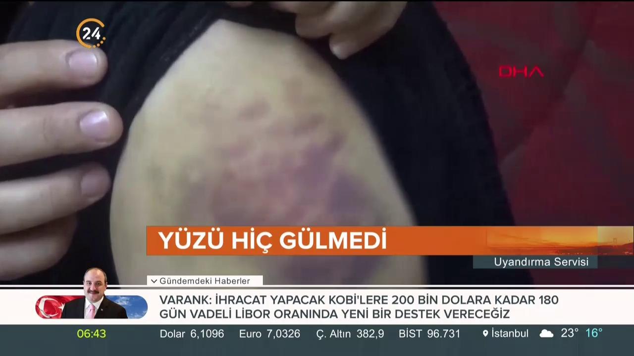 Şiddetten kurtulamadı