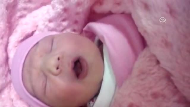 Dokuz Dişli Doğan Bebek Şaşırttı