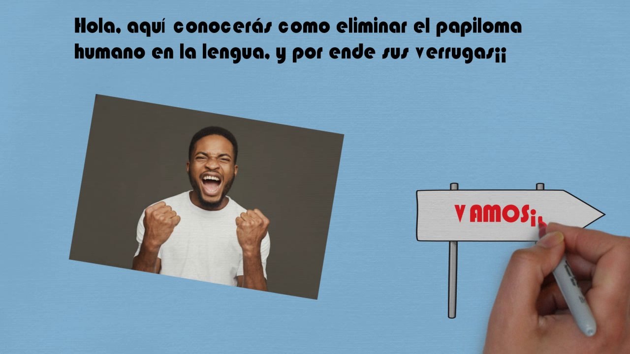 ▷ Como CURAR el Papiloma en la LENGUA | TRATAMIENTO CASERO que NO conoces