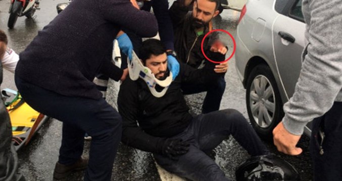 3 Aracın Karıştığı Kazada Motosiklet Sürücüsünün Parmağı Koptu