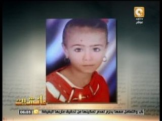 سقوط بوابه مدرسه على طفله عمرها 4 سنوات