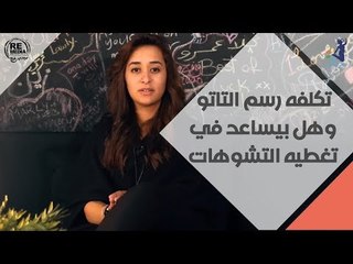 انتي أنيقة - تكلفة رسم التاتو وهل بيساعد في تغطية أي تشوهات بالجسم ؟ - مع عليا فضالي