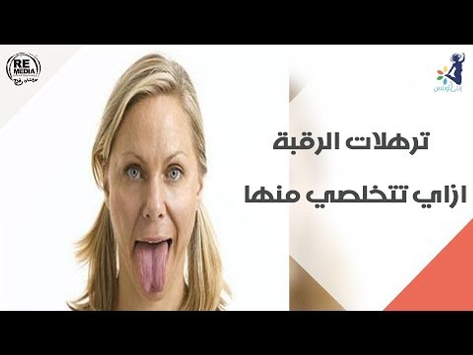 ترهلات الرقبة وازاي تتخلصي منها