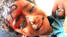 شاهد كيف يعانى أطفال اليمن من قصف ميلشيات الحوثى لمدينة التحيتا بـالهاون