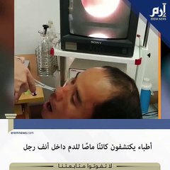 شاهد: كائن غريب يمتص الدم داخل أنف الرجال!