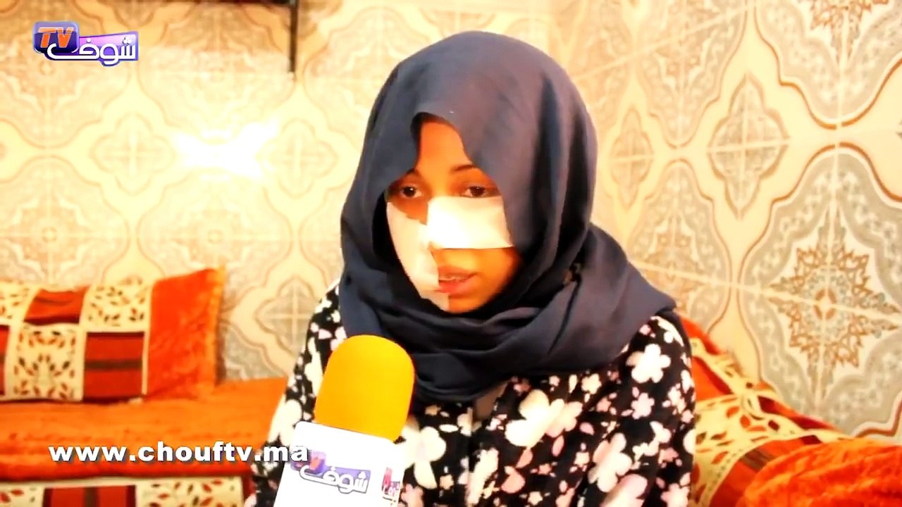 تصريح صادم وبالدموع..زوجة شابة شرملها راجلها بفاس: "بغيت طلاق وشدني هو والأم ديالو وشرملوني فوجهي"
