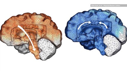 This is What a Brain Taken Over By Alzheimer’s Looks Like