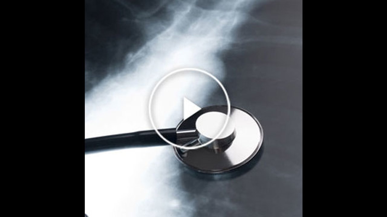 Científicos del CNIO logran curar la fibrosis pulmonar en ratones