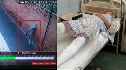 यूपी: फर्जी निकला समीना पर हुआ एसिड अटैक, सीसीटीवी ने खोली पोल