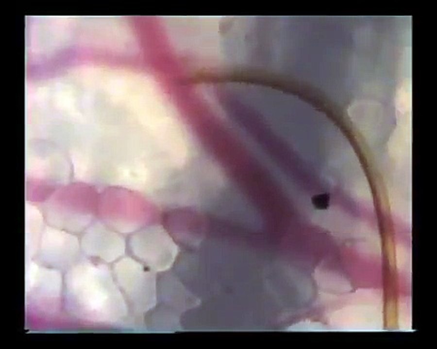 Sivrisineğin damarı bulduğu an