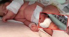 Konya'da doğumdan 1 saat sonra ısıtıcının yanına bırakılan bebeğin sırtı yandı