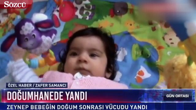 Doğumdan 1 Saat Sonra Isıtıcının Yanına Bırakılan Bebeğin Sırtı Yandı