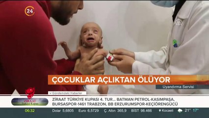 2030 yılına kadar açlık oranının sıfıra çekilmesini hedefleniyor