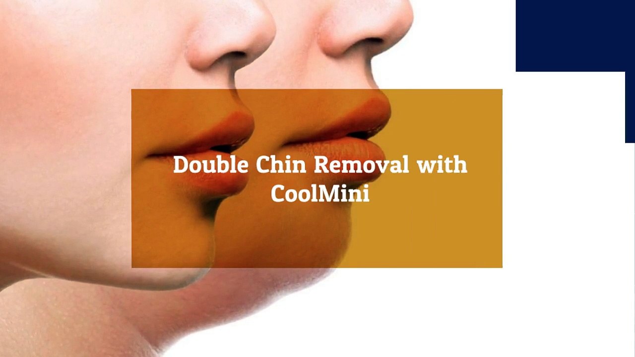 Double Chin Removal with CoolMini - Canada Medlaser Clinics