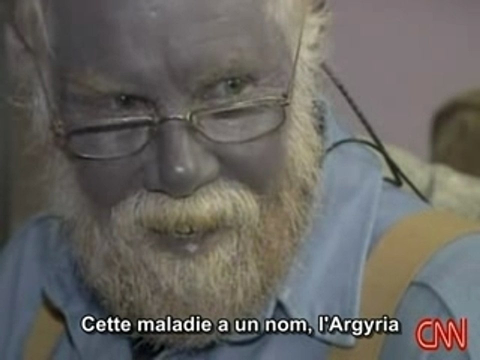 Paul Karason se transforme en Schtroumpf