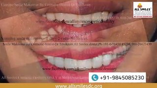 Smile Makeover Before and After | Cosmetic Dentistry in Bangalore, India