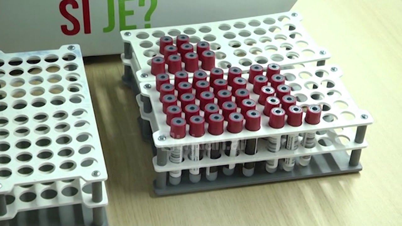 PD: "Stopi" provoi deshtimin e koncesionit te check-up
