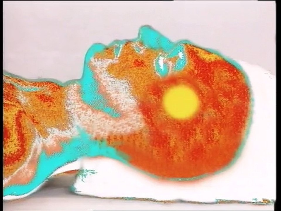 Fièvre