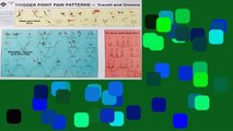 Review  Trigger Point Pain Patterns Wall Charts