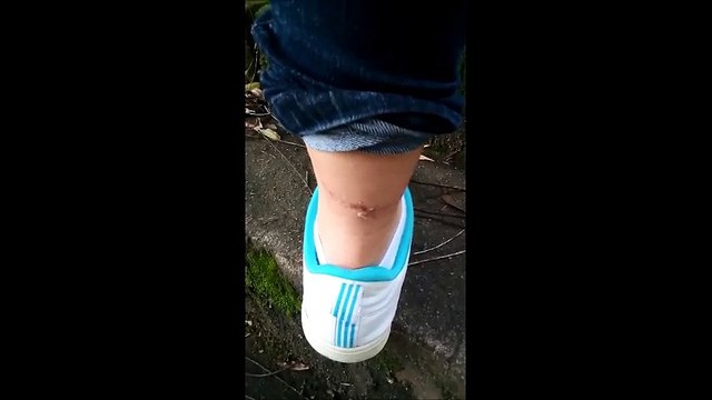 Estudante é atacada por lagarto no Campus de Maruípe, na Ufes