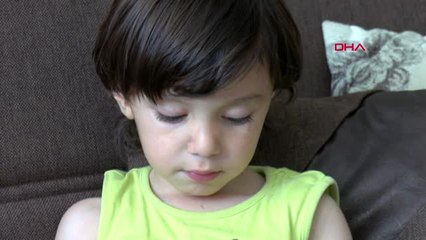 Antalya Dağ Kızağı, Minik Batuhan'ın Kolunun Üstünden Geçti Yeniden