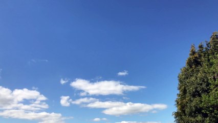 Pigeons -#낙태수술 [낙태수술비용 ssuu22299@gmail.com  ~메일로 문의하세요.] 낙태비용