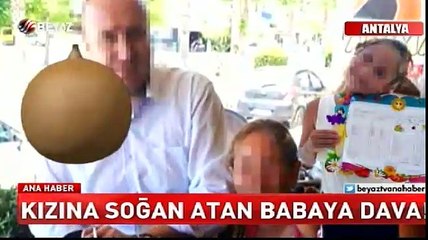 Kızına soğan atan babaya dava!