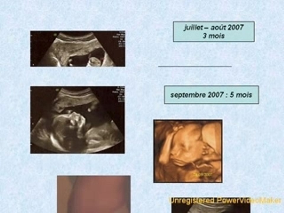 Mini diapo bb-12-27-18-13_wmv