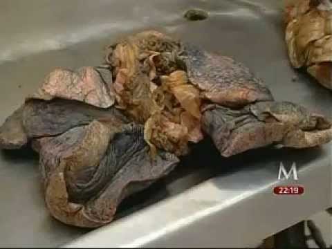 Experimentan con nueva técnica forense para identificación de cadáveres