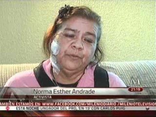 La activista Norma Andrade habló a MILENIO sobre su ataque en el DF