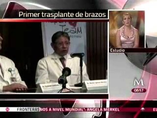Rehabilitación favorable del hombre al cual le fueron trasplantados los brazos en México