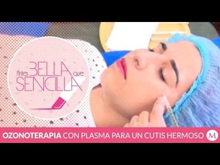 Antes Bella Que Sencilla | Ozonoterapia con plasma para un cutis hermoso