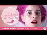 Antes Bella Que Sencilla - Agujas vs arrugas, acupuntura estética