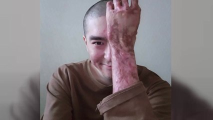 [좋은뉴스] "상처 극복"...밝은 근황 전한 이찬호 씨 / YTN