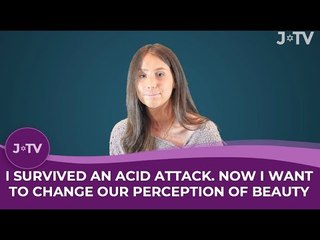 I survived an acid attack. Now I want to change our perception of beauty.