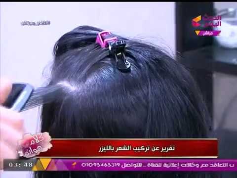 كلام هوانم مع عبير الشيخ | تركيب الشعر بالليزر مع وليد فرج من بيوتي سنتر أحمد لطفى 3-8-2017