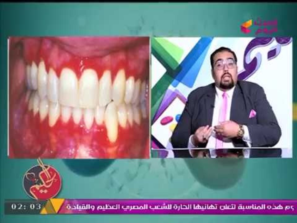 طبيب أسنان يكشف خطورة "التدخين" على اللثة!
