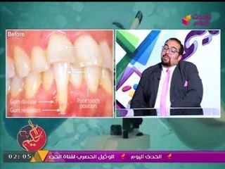 طبيب أسنان يوضح "آلام شائعة" تصاحب المرأة الحامل وطرق العلاج