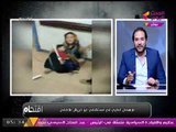 والد ضحية الإهمال بأبو الريش: «طفايات» حريق المستشفي فيها براز «قطط»!!