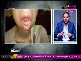 والدة «رحاب» ضحية الخطأ الطبي تكشف لـ"اقتحام" مأساة ابنتها! (+18)